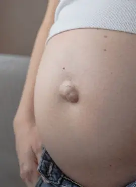 Cirugía de Hernia Umbilical en Iztapalapa