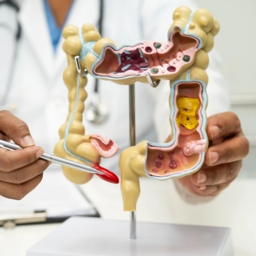 Cirujano Gastrointestinal en Iztapalapa