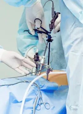 cirugia-hernia-laparoscopica Cirugía de Hernia Inguinal en Iztapalapa