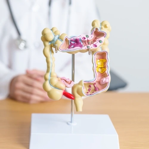 Cirujano Gastrointestinal en Iztapalapa