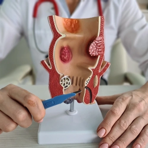Cirujano Gastrointestinal en Iztapalapa