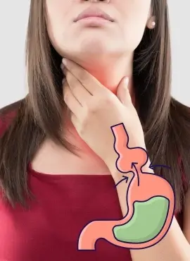 hernia-hiatal Cirugía de Hernia Hiatal en Iztapalapa