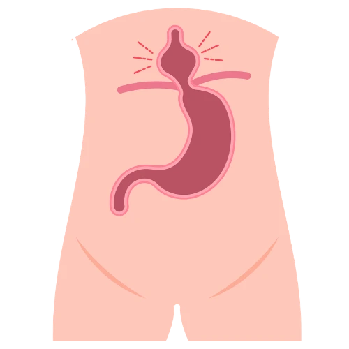 Cirugía de Hernia en Iztapalapa