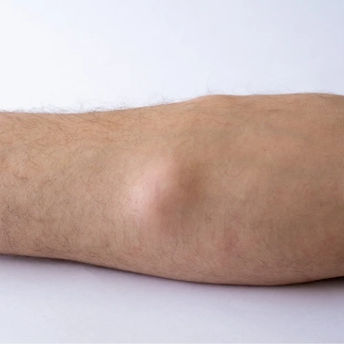 Cirujano Gastrointestinal en Iztapalapa