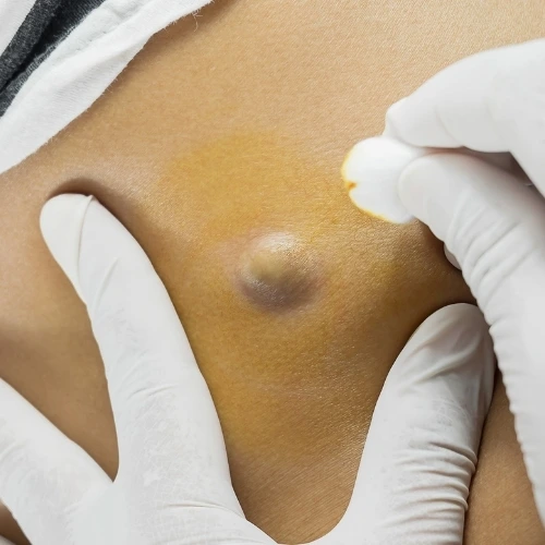 Cirujano Gastrointestinal en Iztapalapa